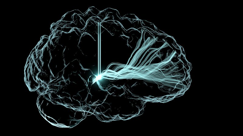 Deep brain stimulation illustration. Free image from: https://foter.com/