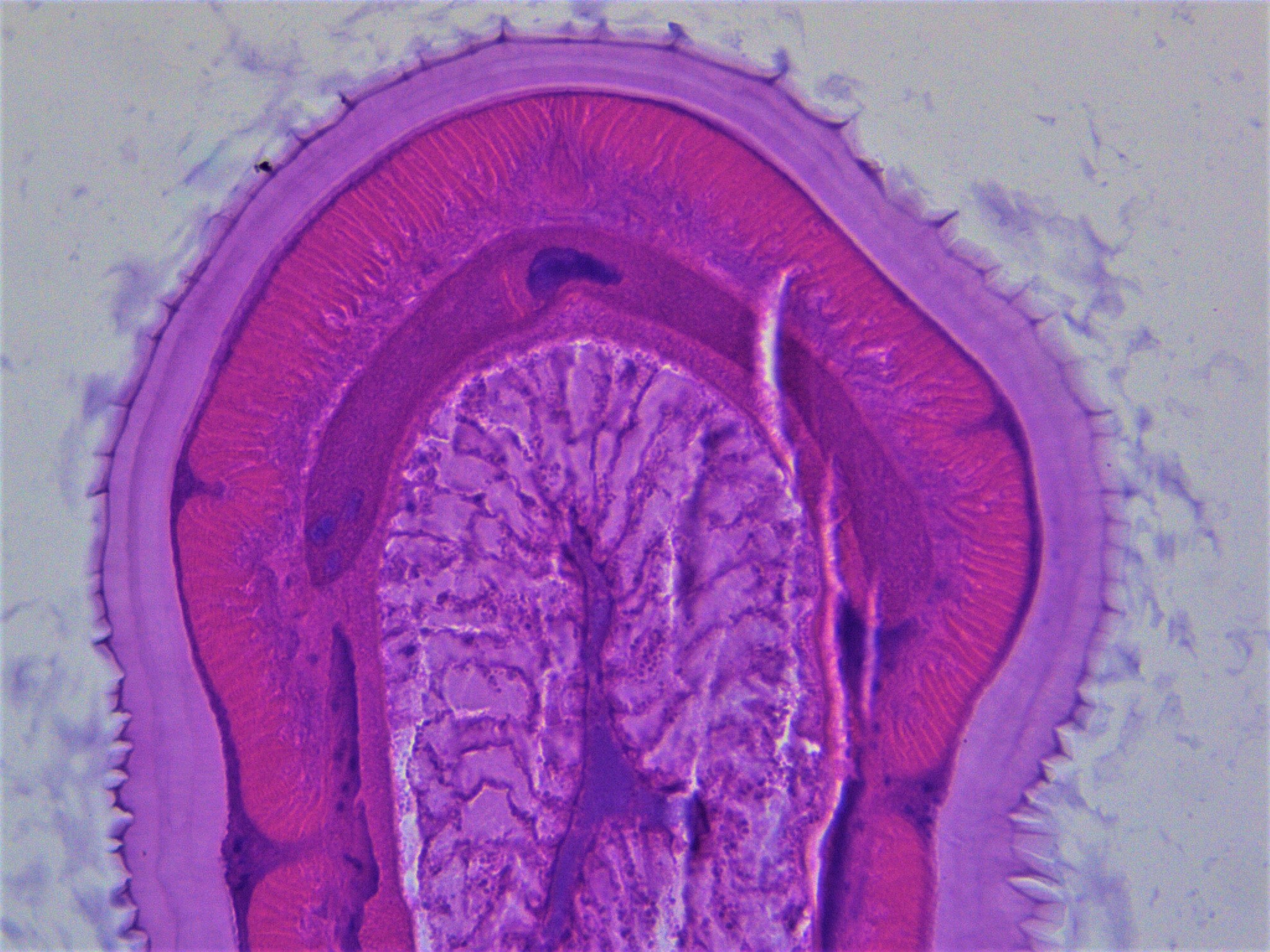 Larva (L3) de nemátodos anisakidos. Sección transversales 40x